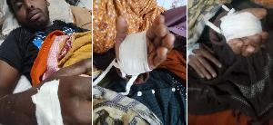 সালথায় সরকারি বিদ্যালয়ের গাছ কাটাকে কেন্দ্র করে সহিংসতা, নারীসহ আহত- ১০