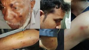 ঈশ্বরদীতে পদ্মায় টহলরত পুলিশের ওপর হামলা ওসি সহ ৫ সদস্য আহত